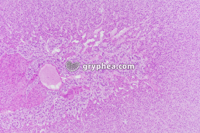 Surrénale - Capsule surrénale - zone médullaire entourée par la zone réticulée x25 - gryphea.com